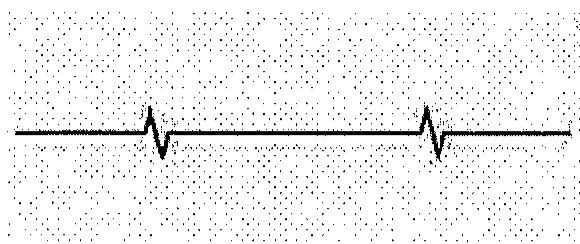 Linha contínua horizontal com dois traços em zigue-zague ao longo de seu comprimento, sobre fundo pontilhado.