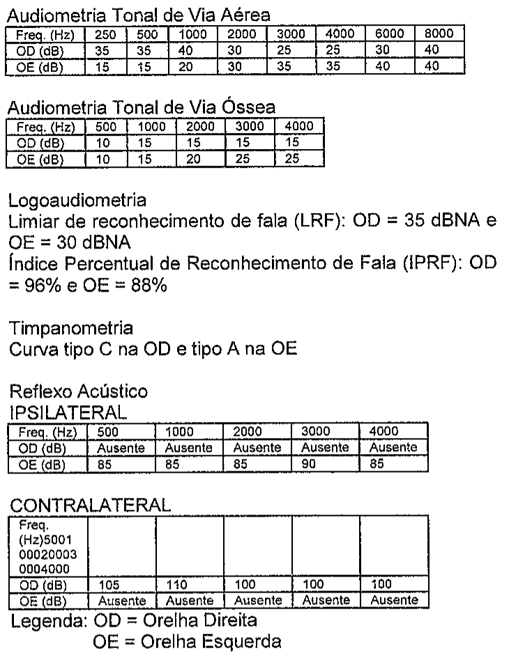 Resultados da avaliação audiológica: tabelas de audiometria tonal por via aérea (250 a 8000 Hz) e por via óssea (500 a 4000 Hz) para OD e OE; logoaudiometria (LRF OD = 35 dBNA e OE = 30 dBNA; IPRF OD = 96% e OE = 88%); timpanometria (curva tipo C na OD e tipo A na OE); tabelas de reflexo acústico ipsilateral e contralateral de 500 a 4000 Hz; legenda OD = Orelha Direita, OE = Orelha Esquerda.