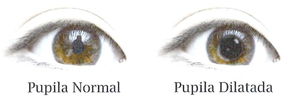 Fotografias de dois olhos lado a lado, legendadas “Pupila Normal” e “Pupila Dilatada”.